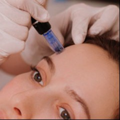 Tratamiento-Dermapunt.jpg
